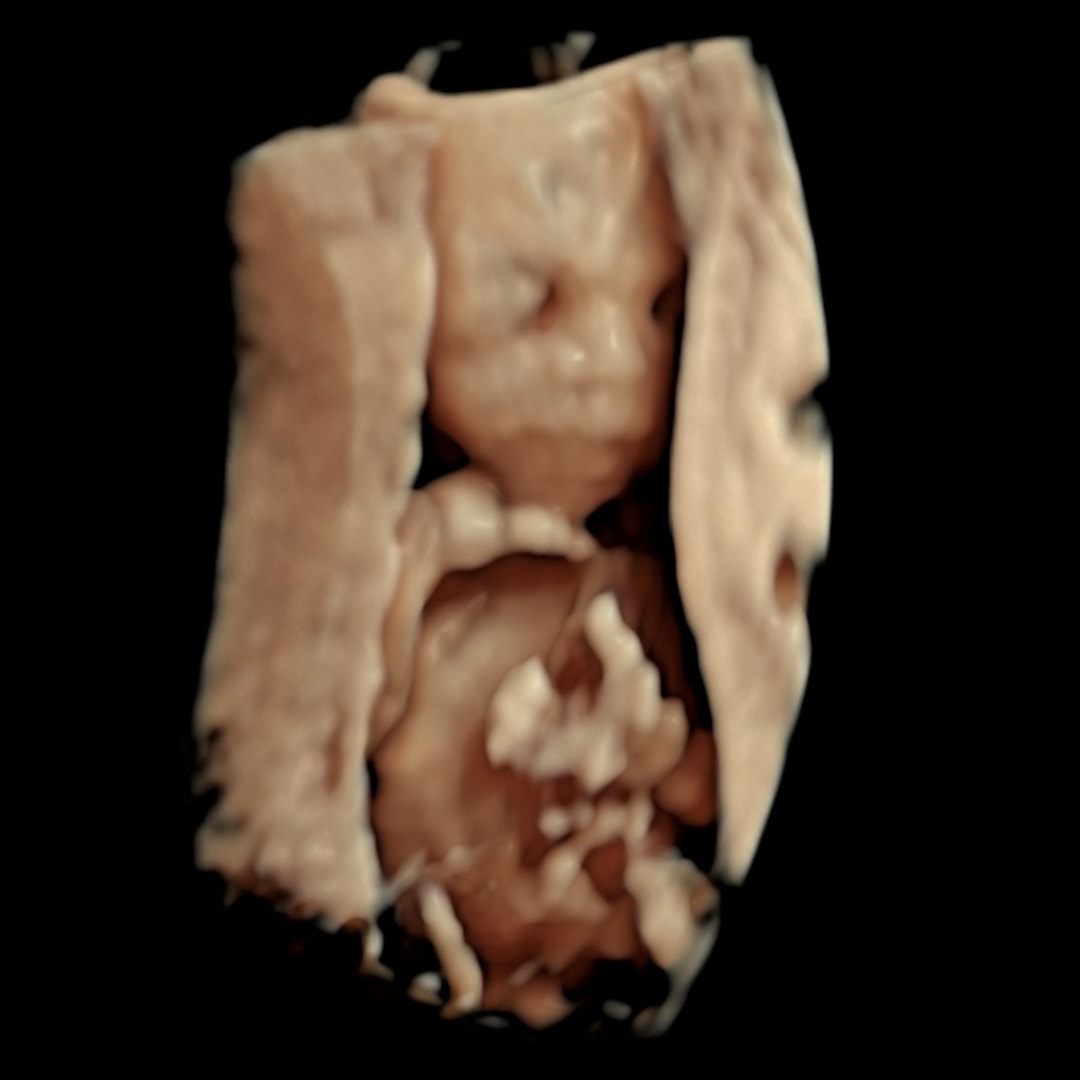 Photo shared by Cassandra for their Babylist baby registry.