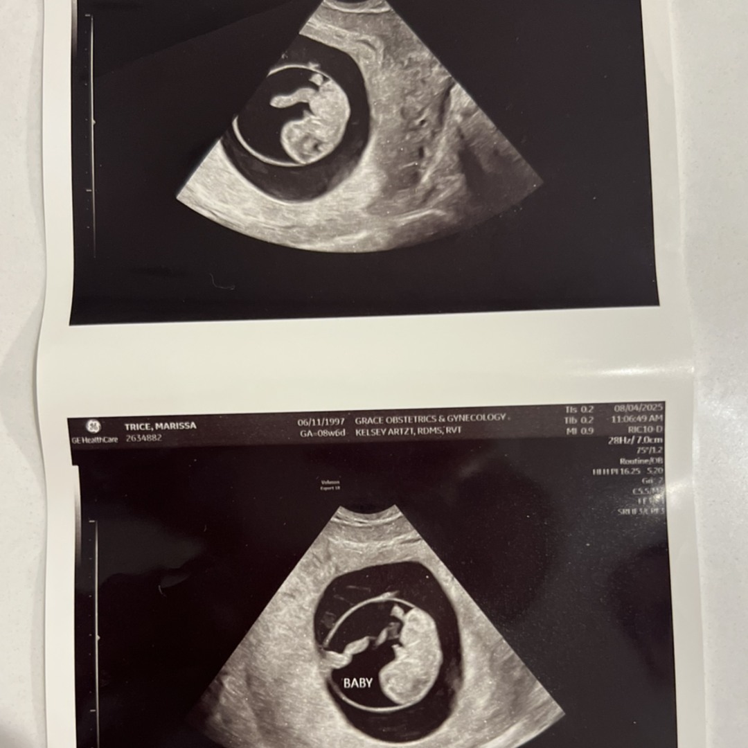 Photo shared by Marissa for their Babylist baby registry.