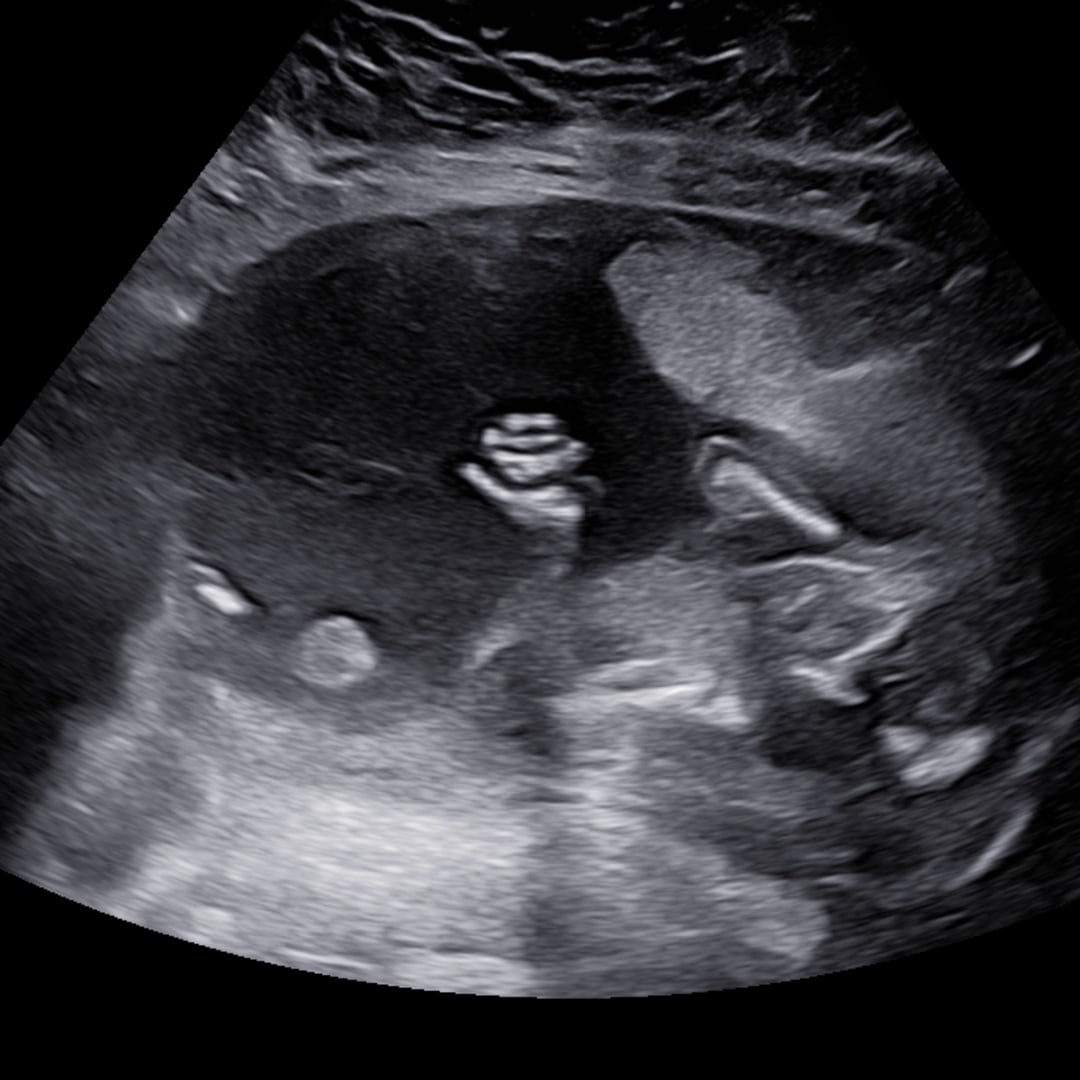 Photo shared by Makenzie for their Babylist baby registry.