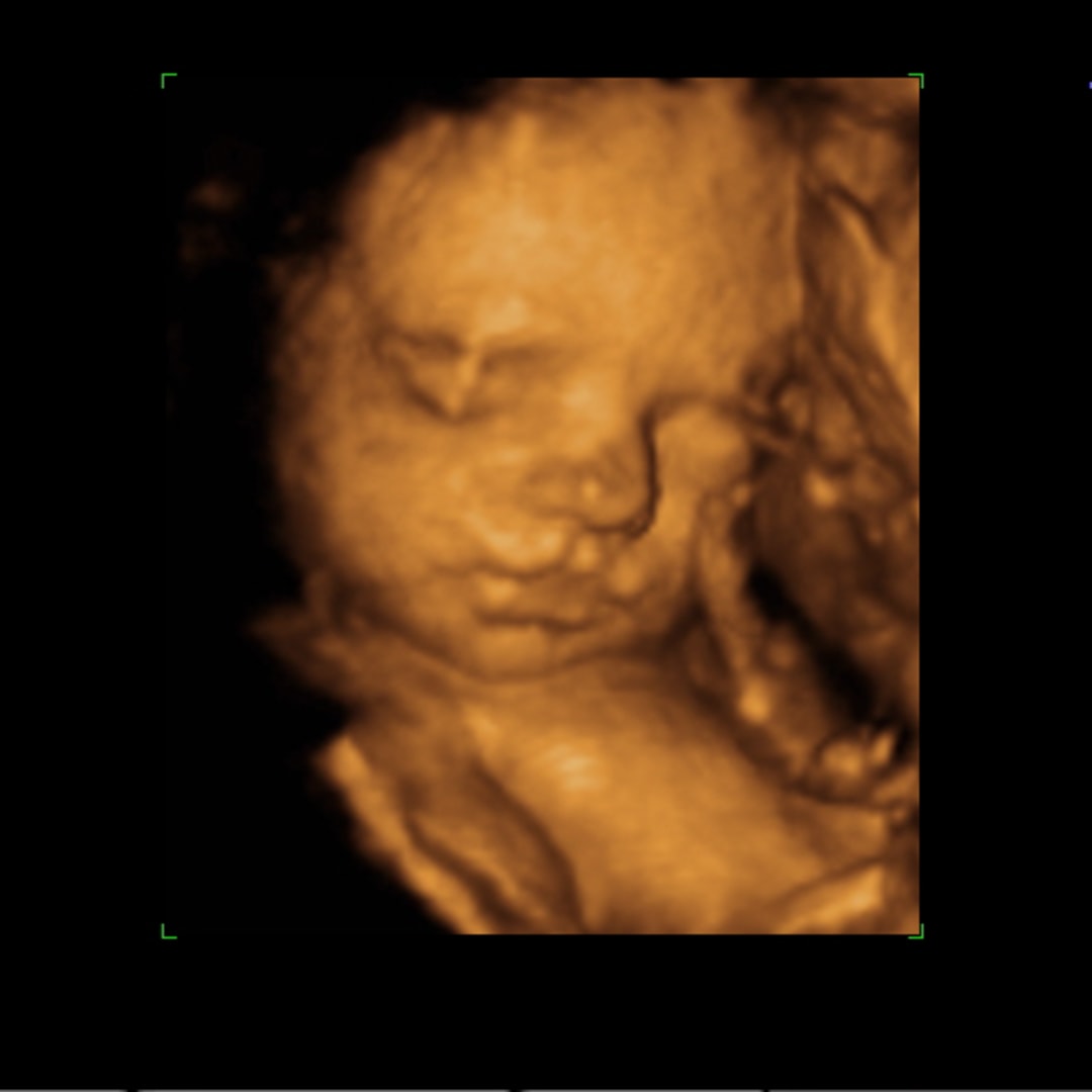 Photo shared by Toni for their Babylist baby registry.