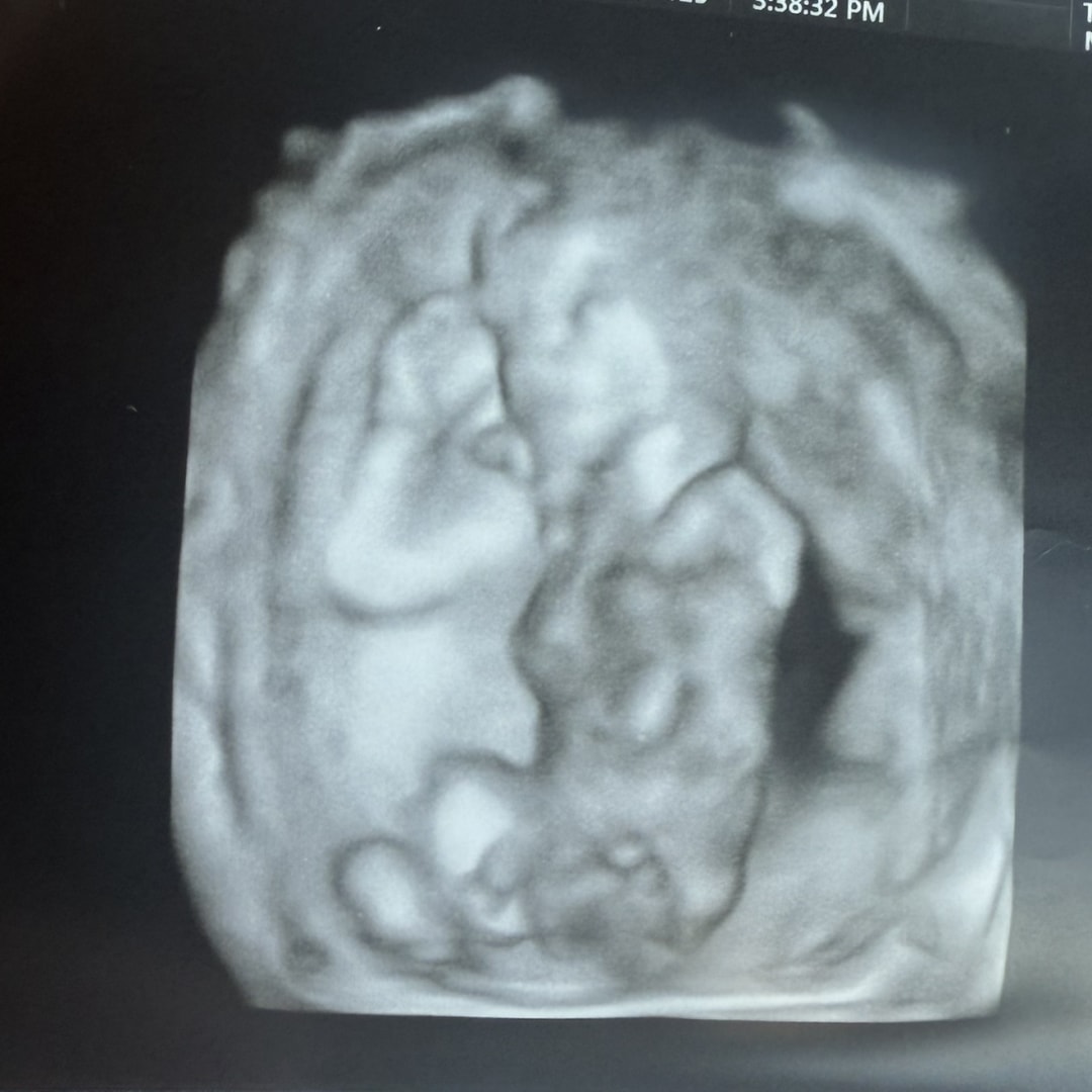 Photo shared by Ashley for their Babylist baby registry.