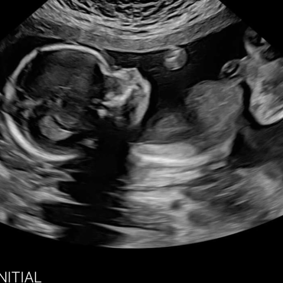 Photo shared by Perla for their Babylist baby registry.