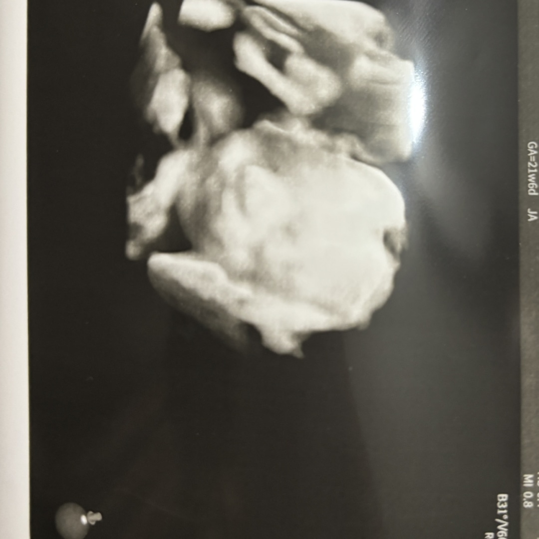 Photo shared by Victoria for their Babylist baby registry.