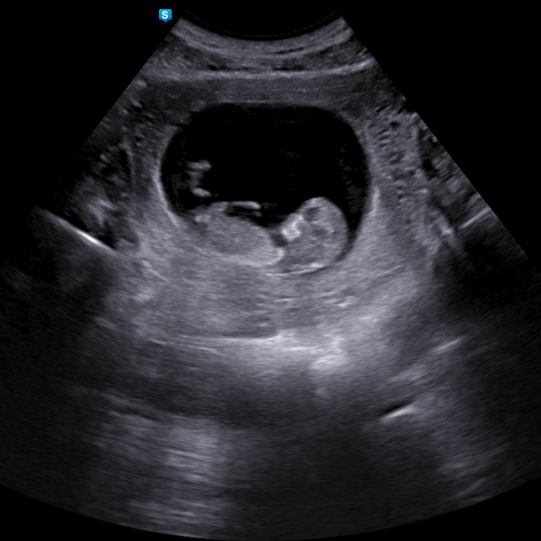 Photo shared by Hallie for their Babylist baby registry.