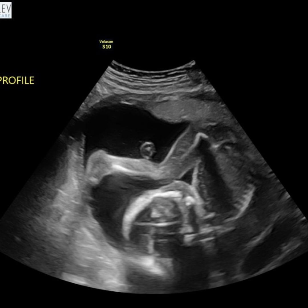 Photo shared by Avery for their Babylist baby registry.