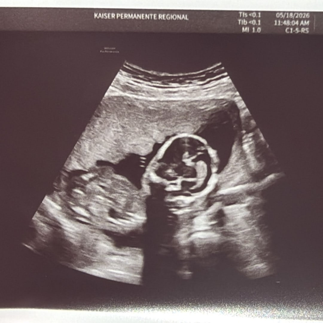 Photo shared by Emily for their Babylist baby registry.