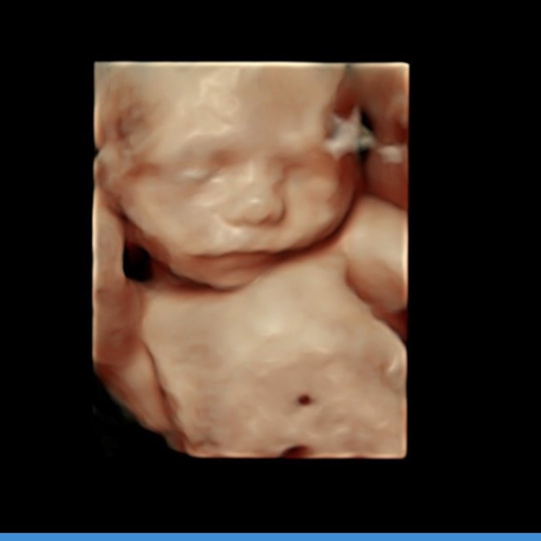 Photo shared by Kayla for their Babylist baby registry.