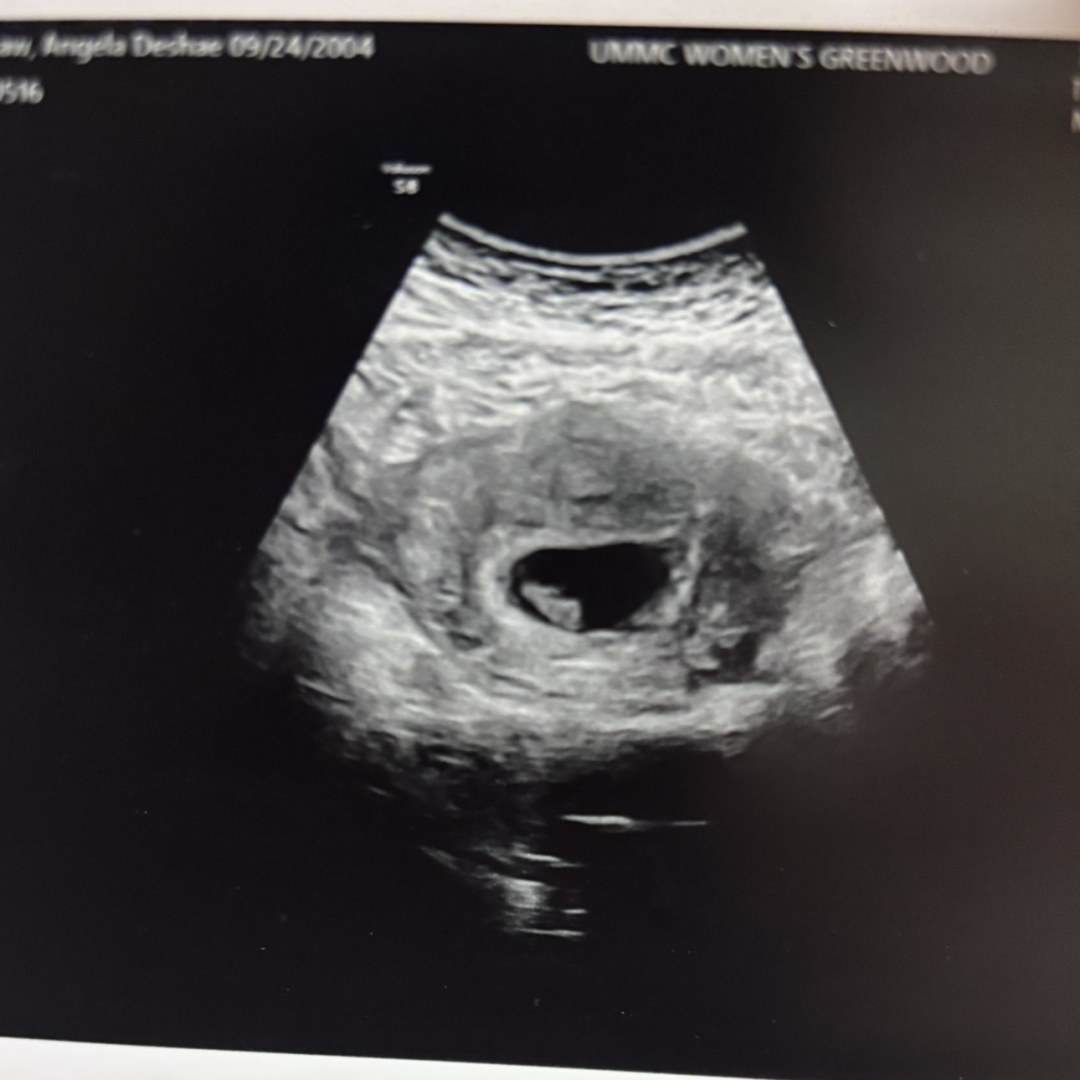 Photo shared by Angela for their Babylist baby registry.