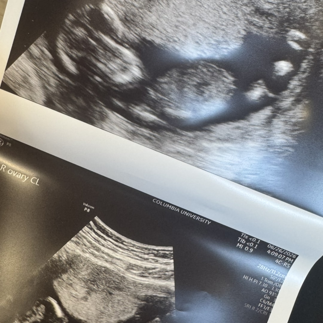 Photo shared by Michelle for their Babylist baby registry.