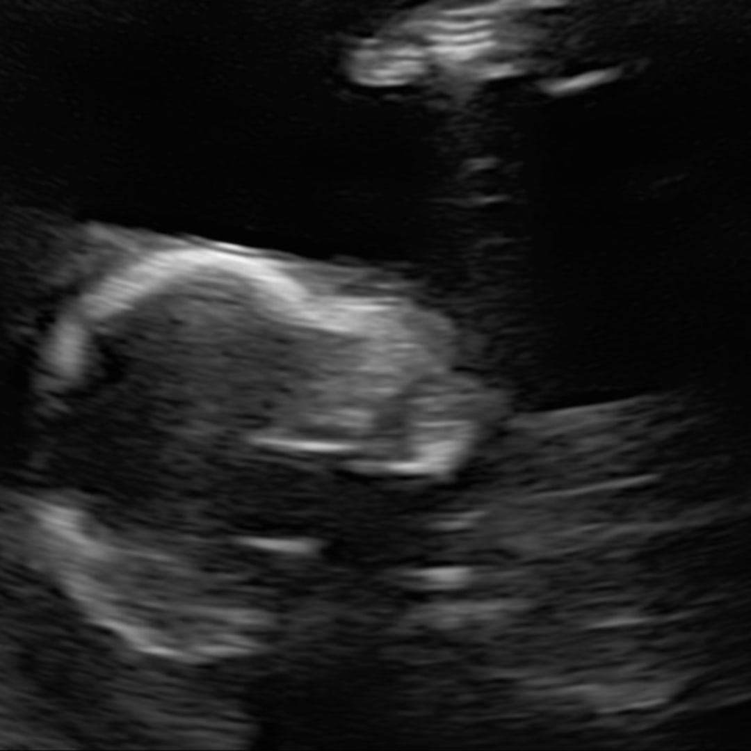 Photo shared by Ciera for their Babylist baby registry.