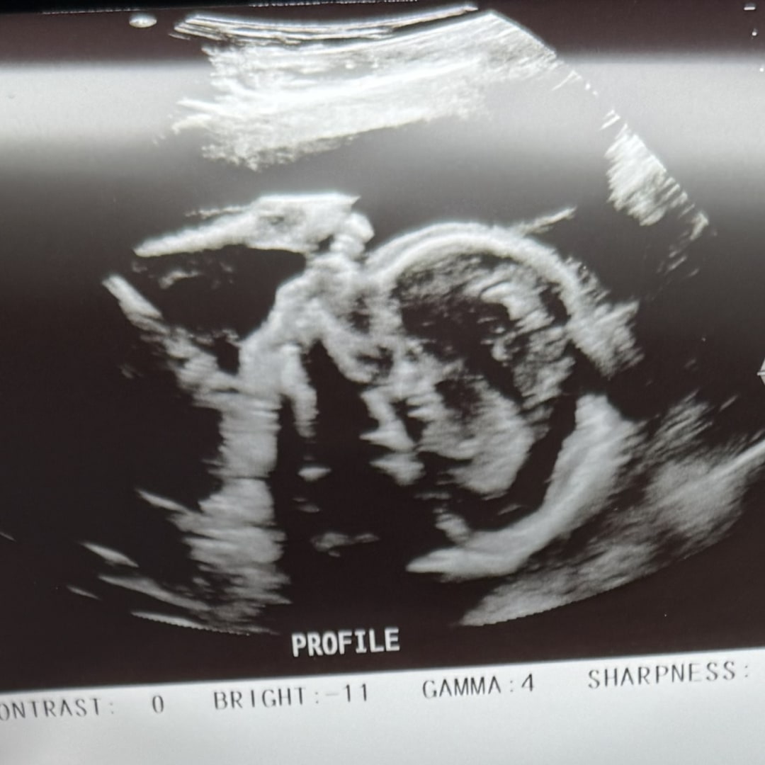 Photo shared by Emma for their Babylist baby registry.