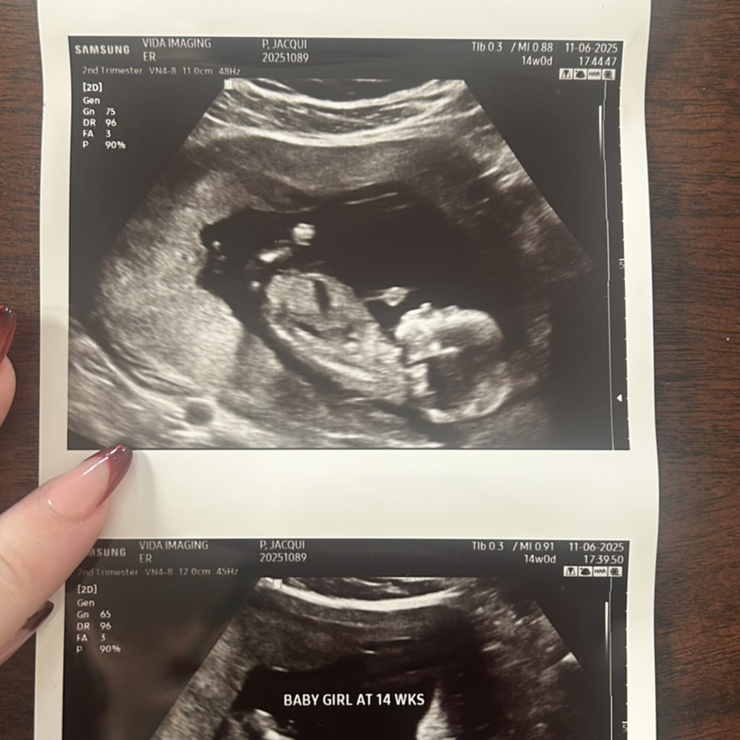 Photo shared by Jacqui for their Babylist baby registry.