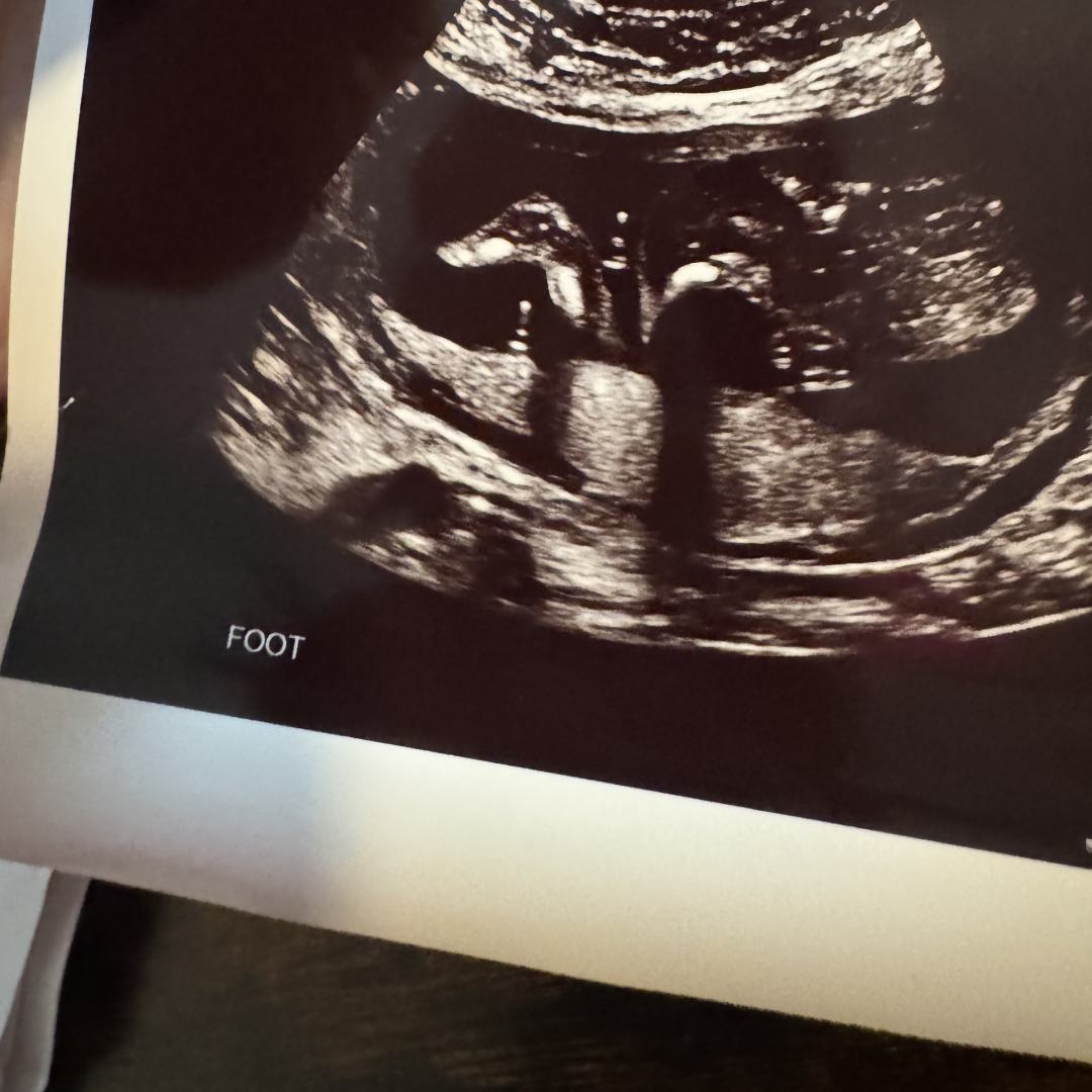 Photo shared by Megan for their Babylist baby registry.