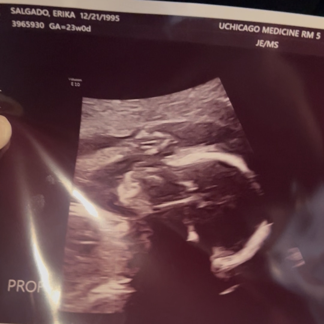 Photo shared by Erika for their Babylist baby registry.