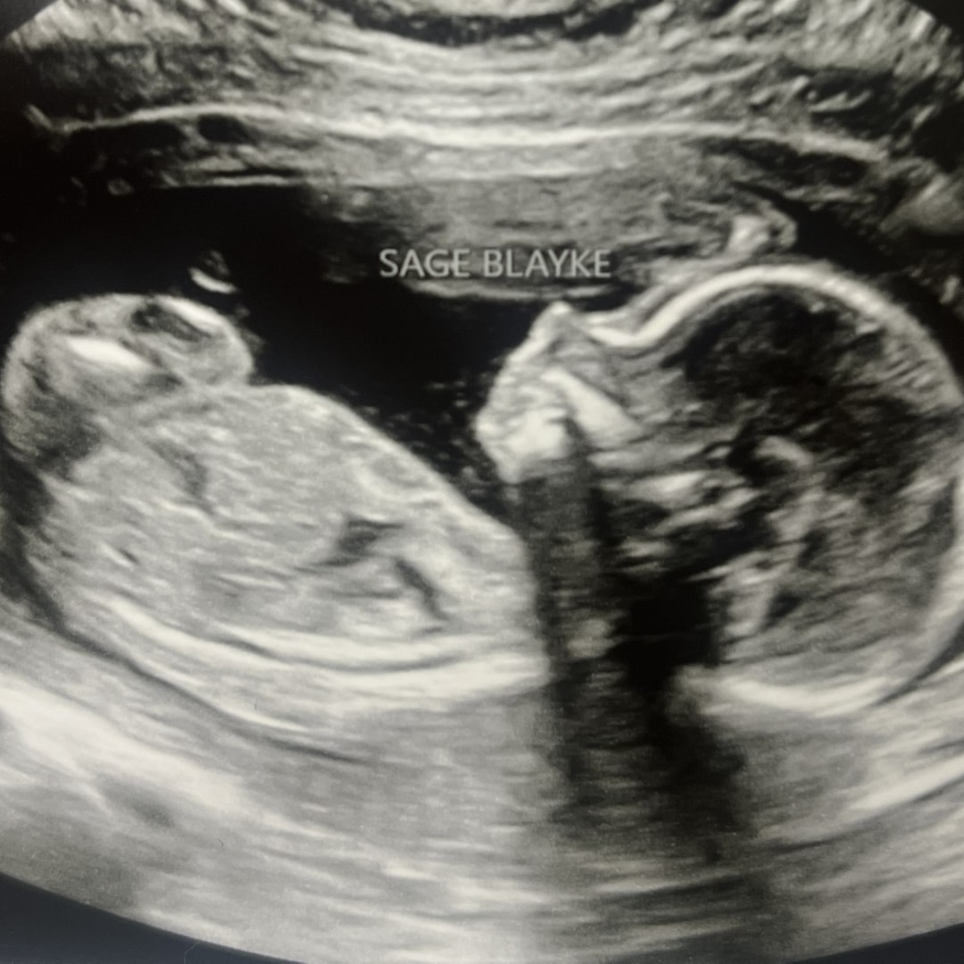 Photo shared by Caraline for their Babylist baby registry.