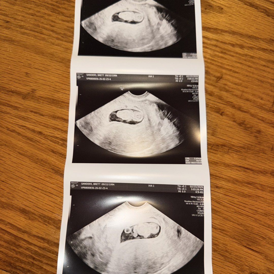 Photo shared by Brett for their Babylist baby registry.
