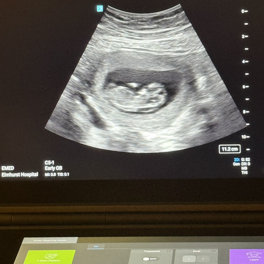 Photo shared by Sarah for their Babylist baby registry.
