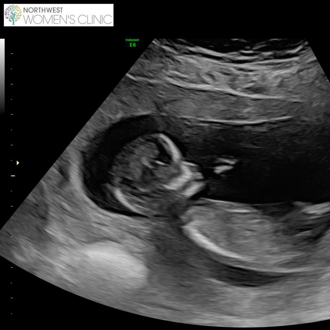 Photo shared by Tanille for their Babylist baby registry.