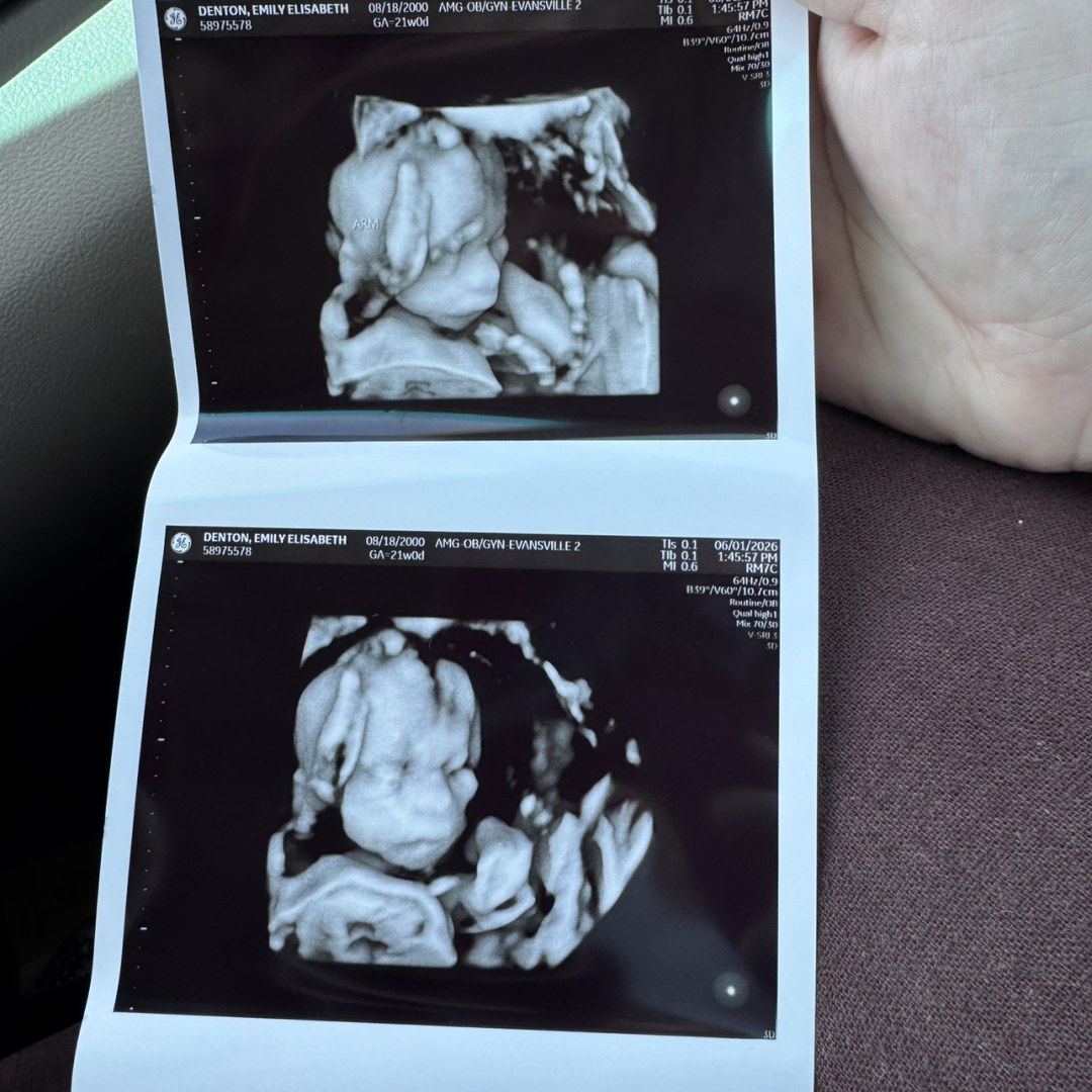 Photo shared by Emily for their Babylist baby registry.