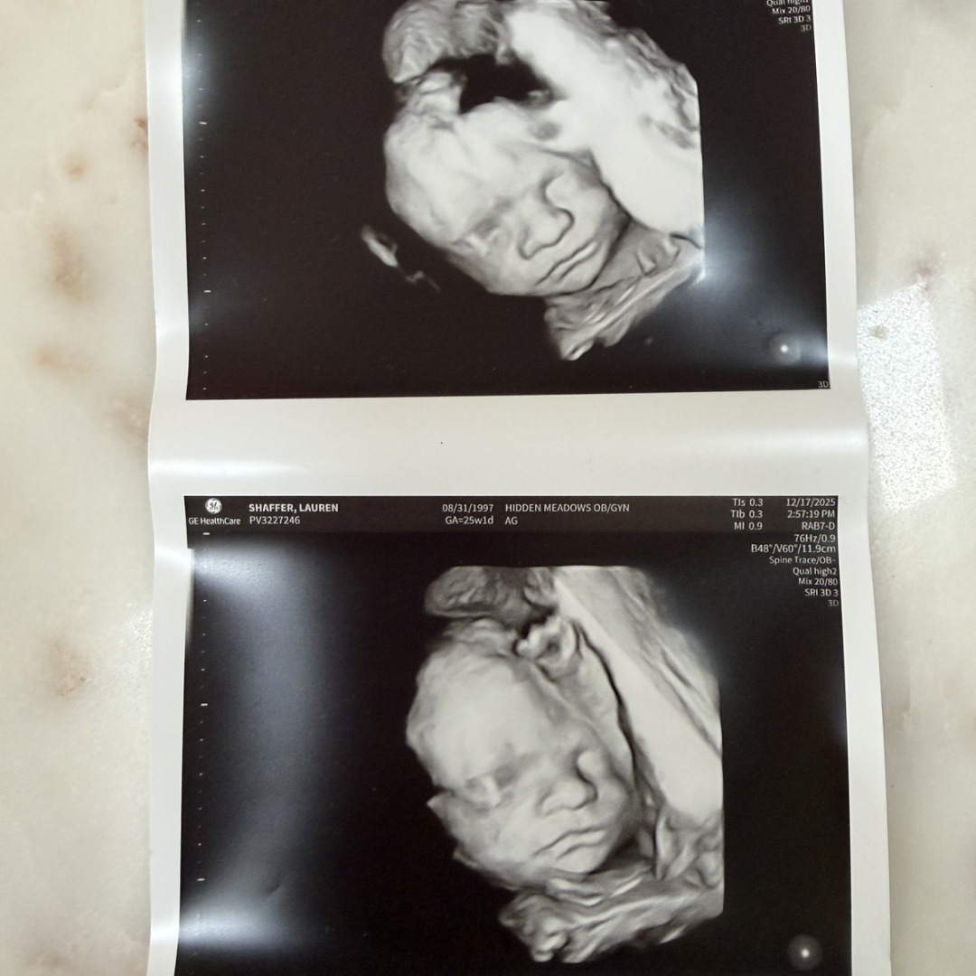Photo shared by Lauren for their Babylist baby registry.