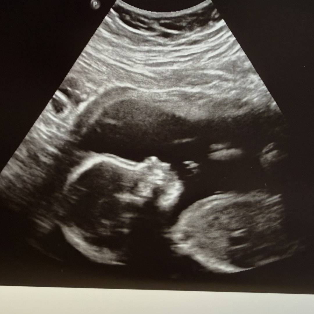 Photo shared by Laura for their Babylist baby registry.