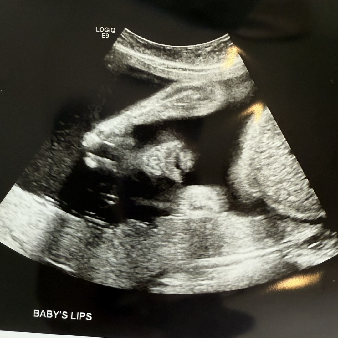 Photo shared by Carly for their Babylist baby registry.