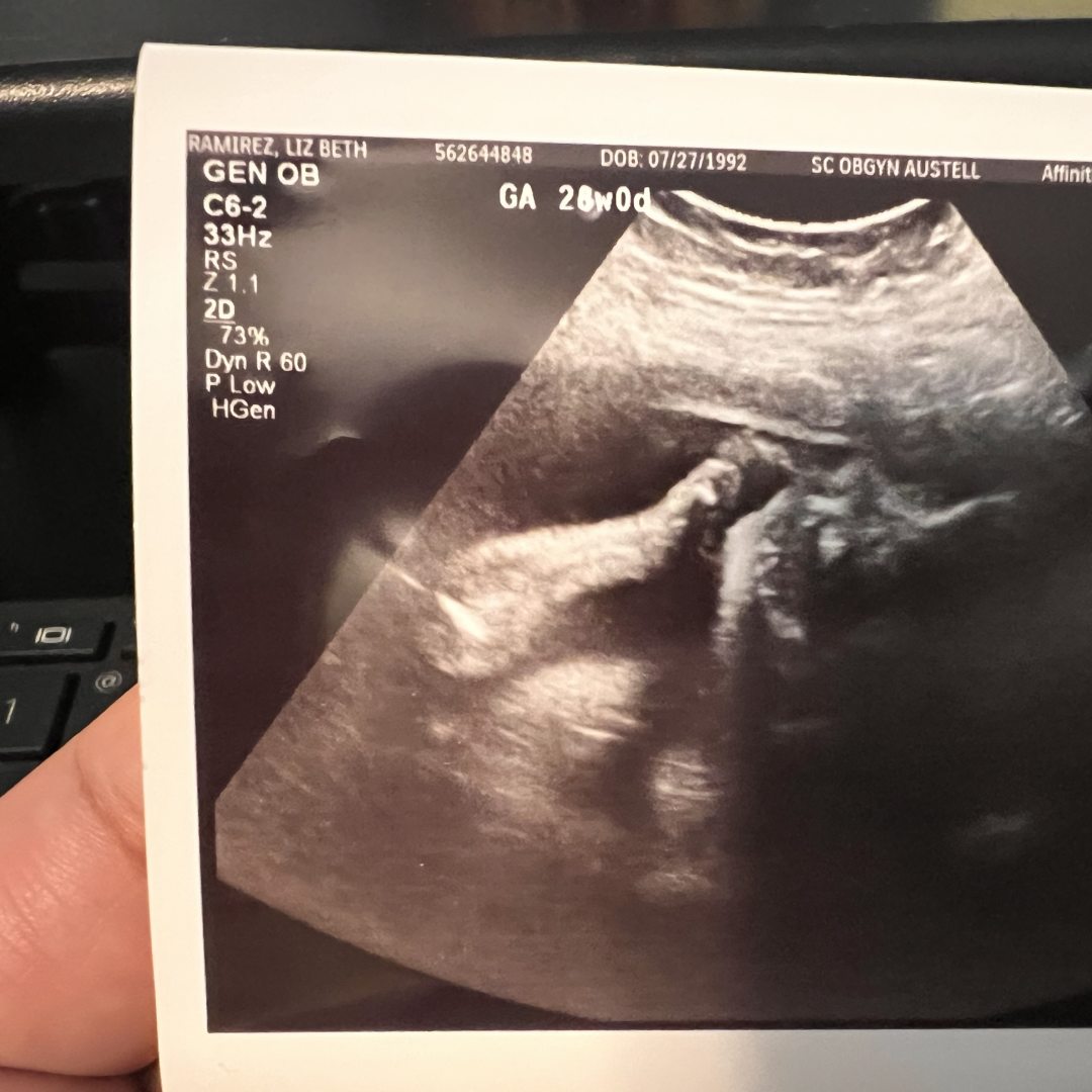 Photo shared by Liz for their Babylist baby registry.