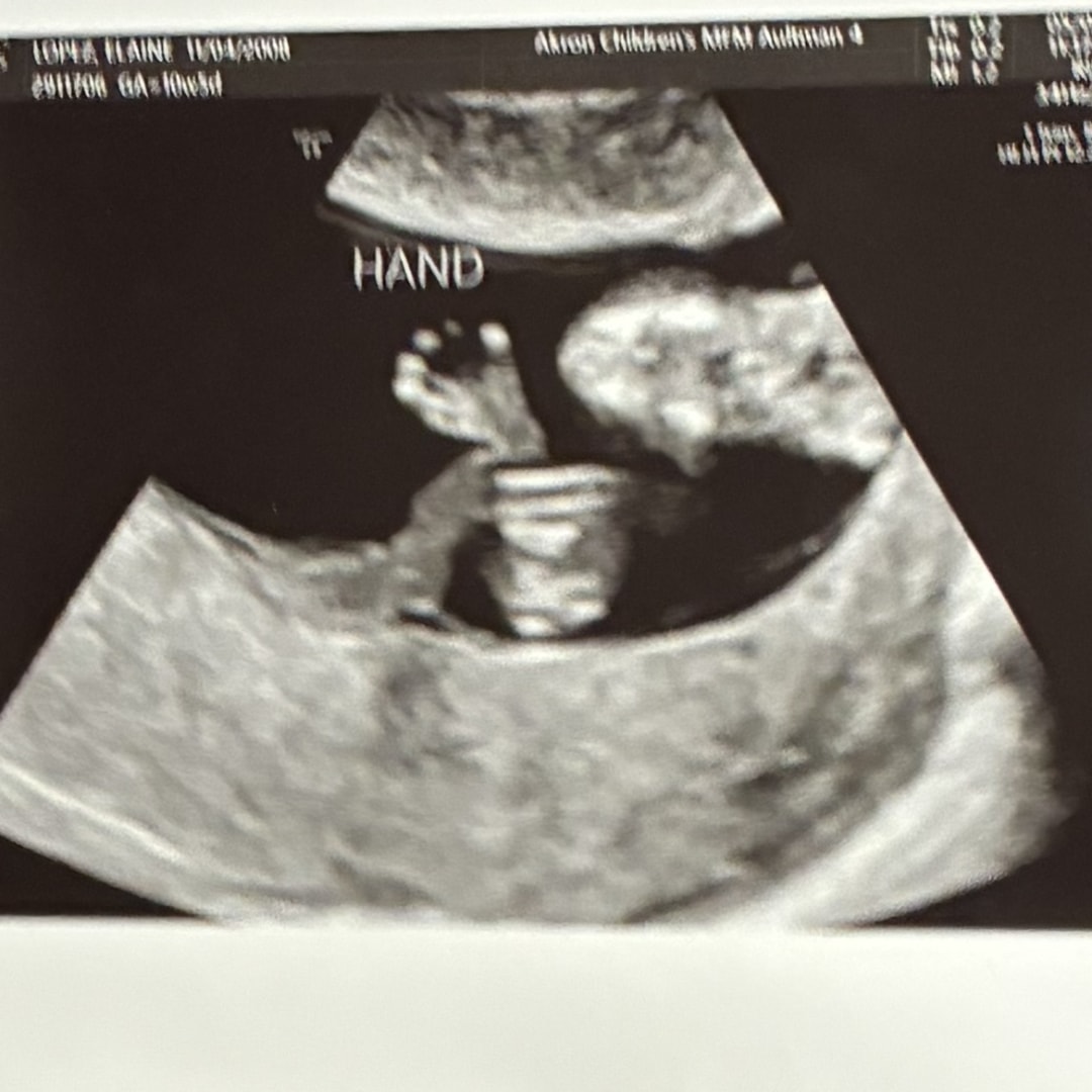 Photo shared by Elaine for their Babylist baby registry.