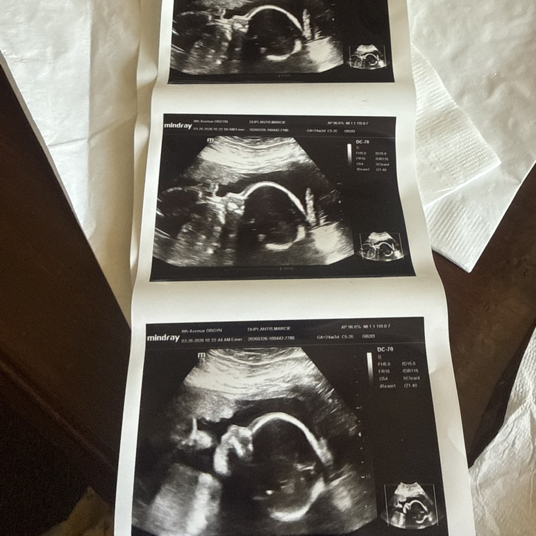 Photo shared by Marcie Ellen for their Babylist baby registry.