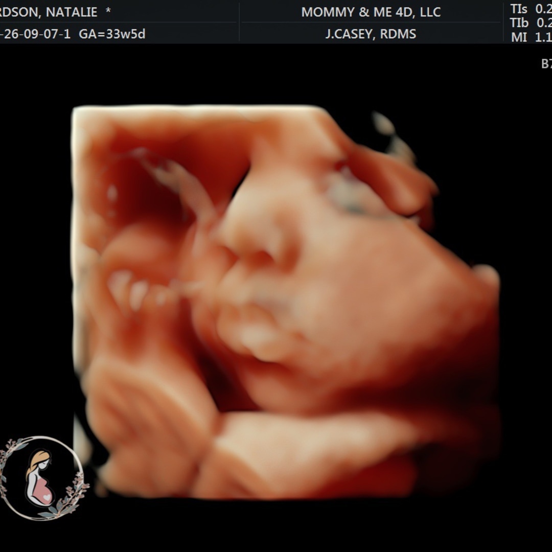 Photo shared by Natalie for their Babylist baby registry.