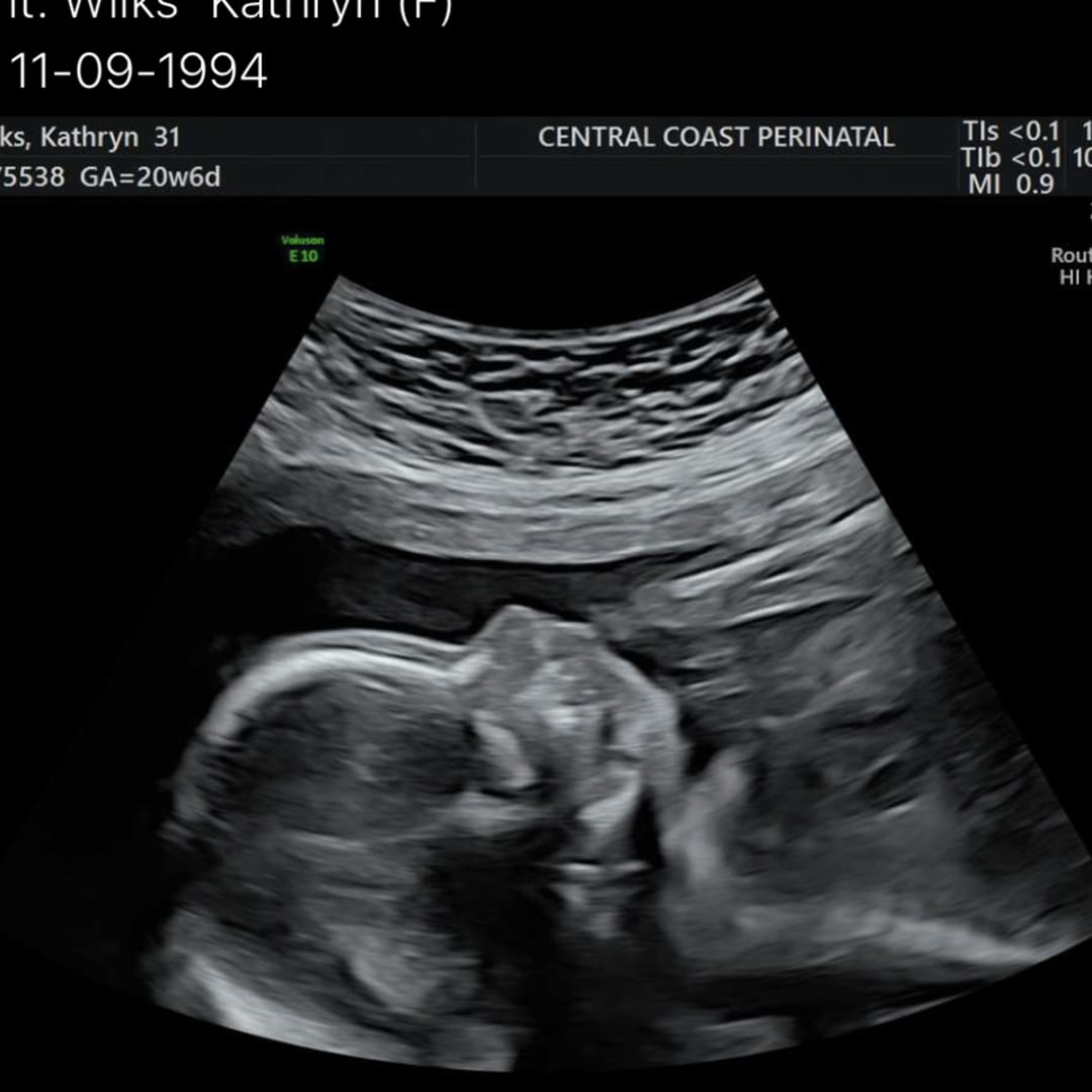 Photo shared by Kayde for their Babylist baby registry.