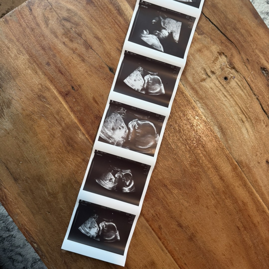 Photo shared by Alexia for their Babylist baby registry.