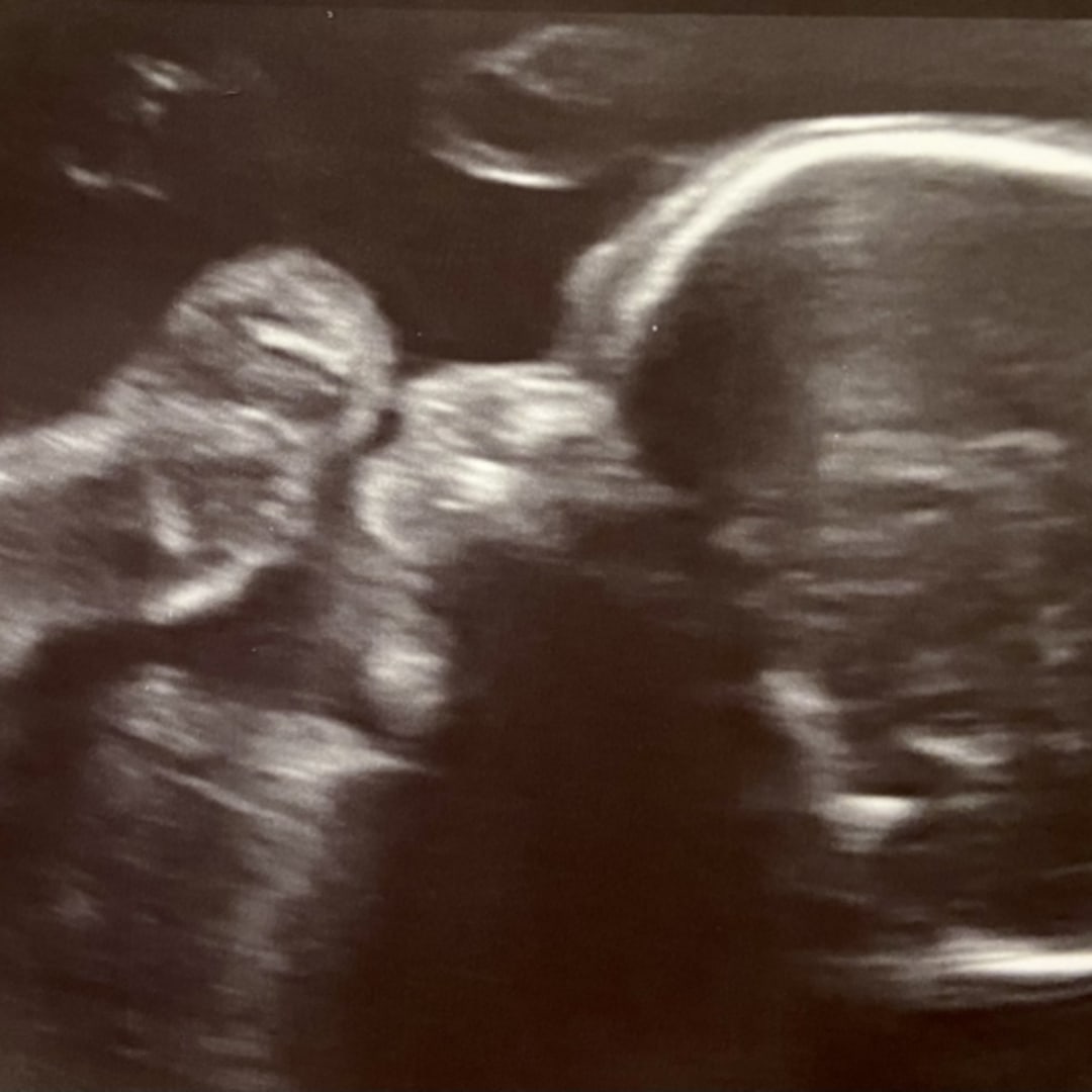 Photo shared by Brook for their Babylist baby registry.