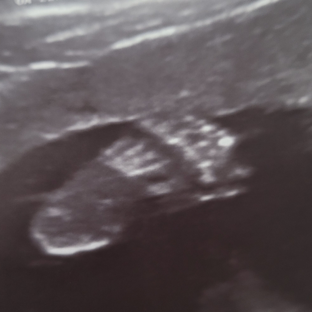Photo shared by Lucy for their Babylist baby registry.