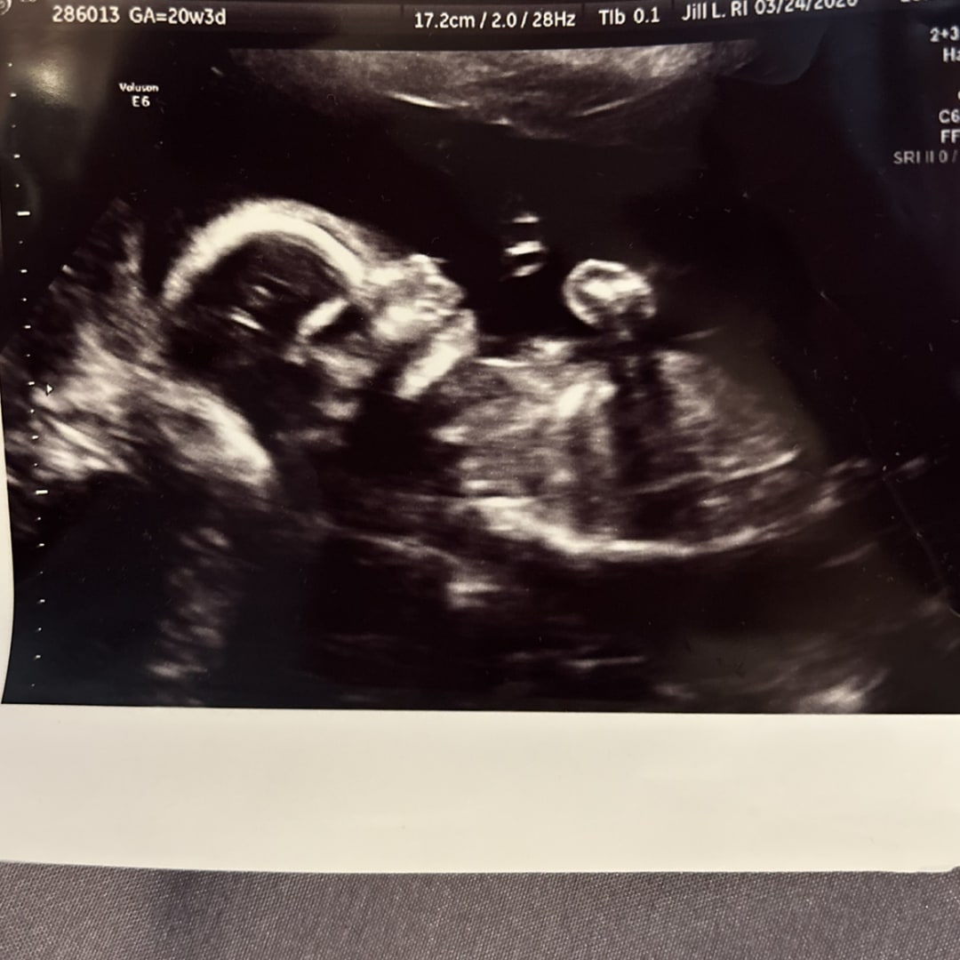 Photo shared by Autumn for their Babylist baby registry.