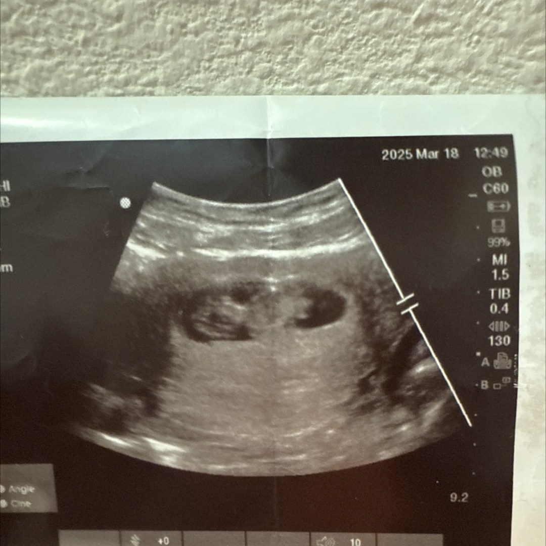 Photo shared by Brianna for their Babylist baby registry.