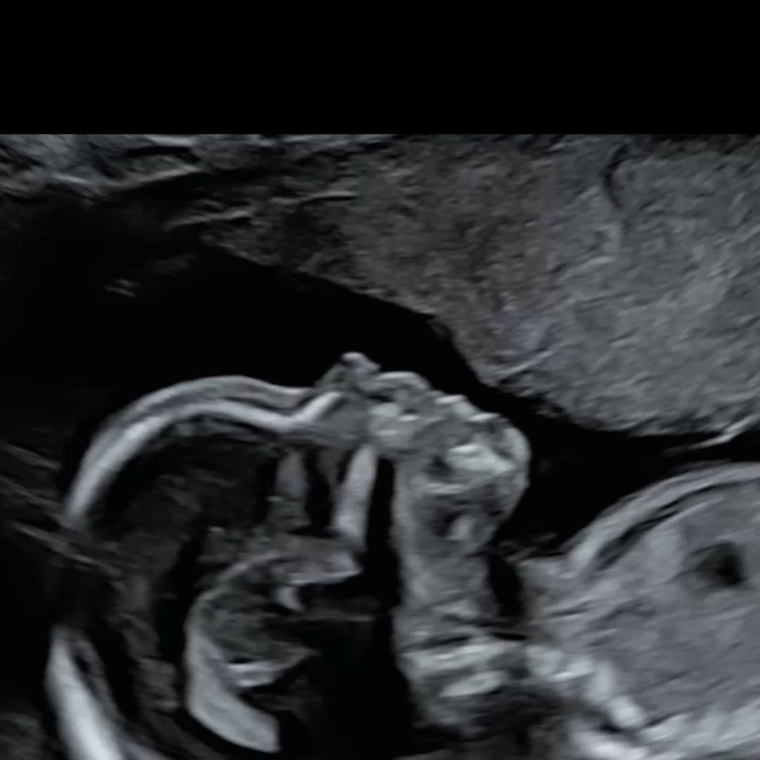 Photo shared by Anaisa for their Babylist baby registry.