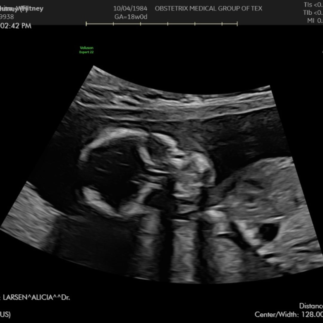 Photo shared by Whitney for their Babylist baby registry.