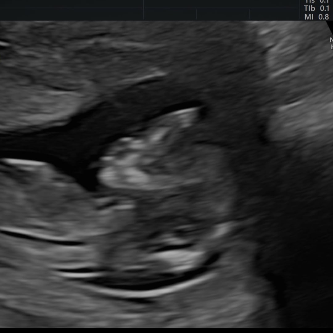 Photo shared by Emily for their Babylist baby registry.