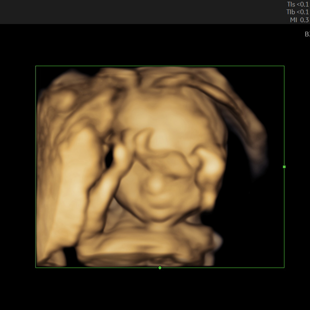 Photo shared by Veronica for their Babylist baby registry.