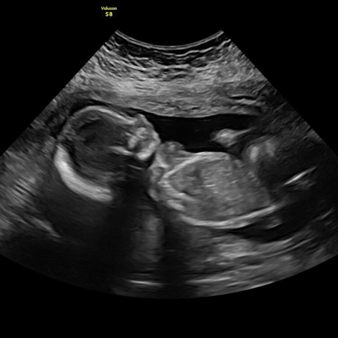 Photo shared by Madi for their Babylist baby registry.