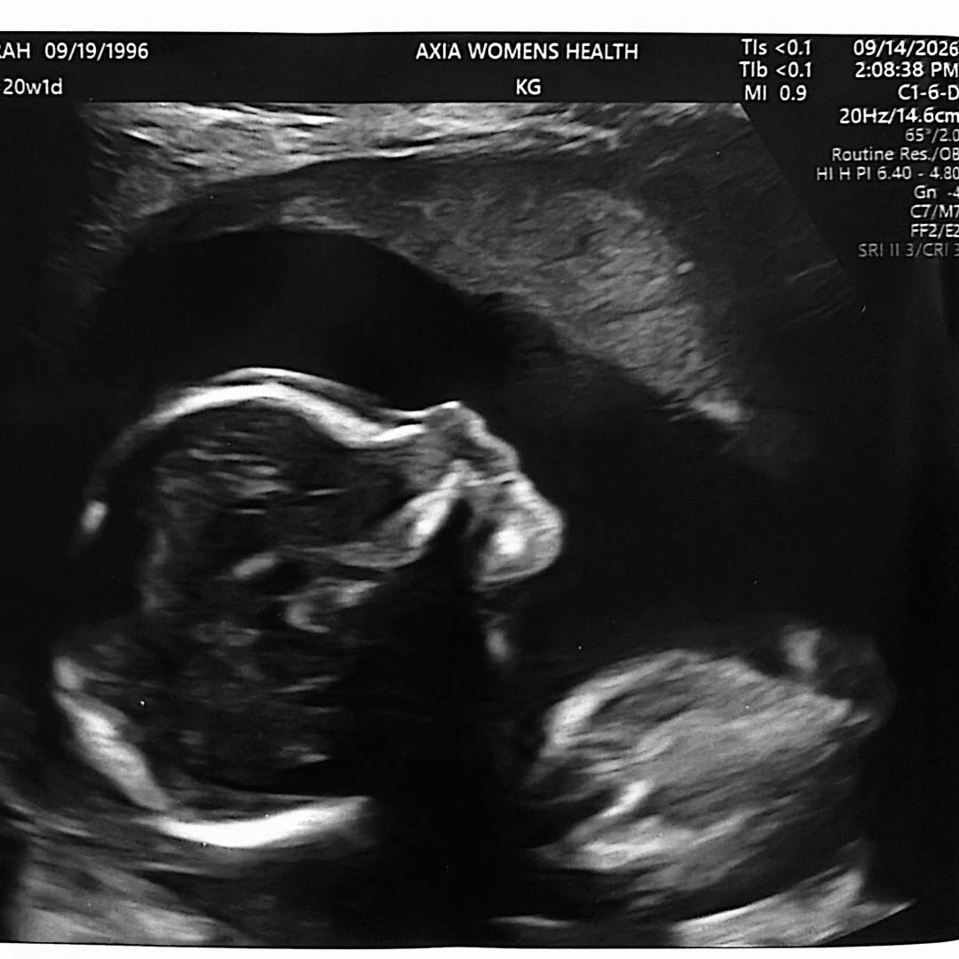 Photo shared by Sarah for their Babylist baby registry.