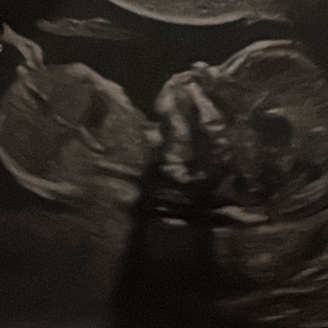 Photo shared by Jenna for their Babylist baby registry.