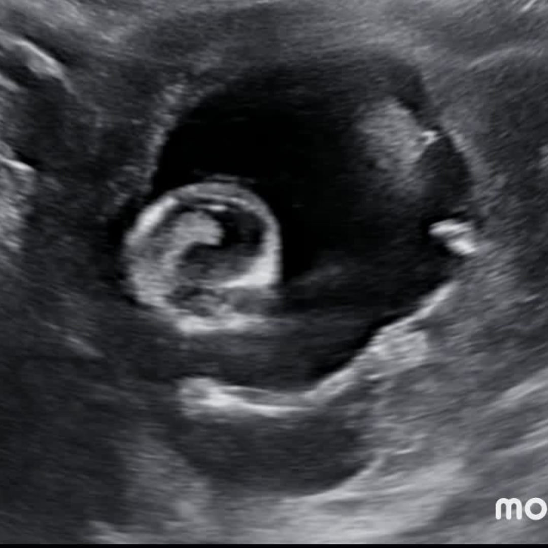 Photo shared by Carli for their Babylist baby registry.