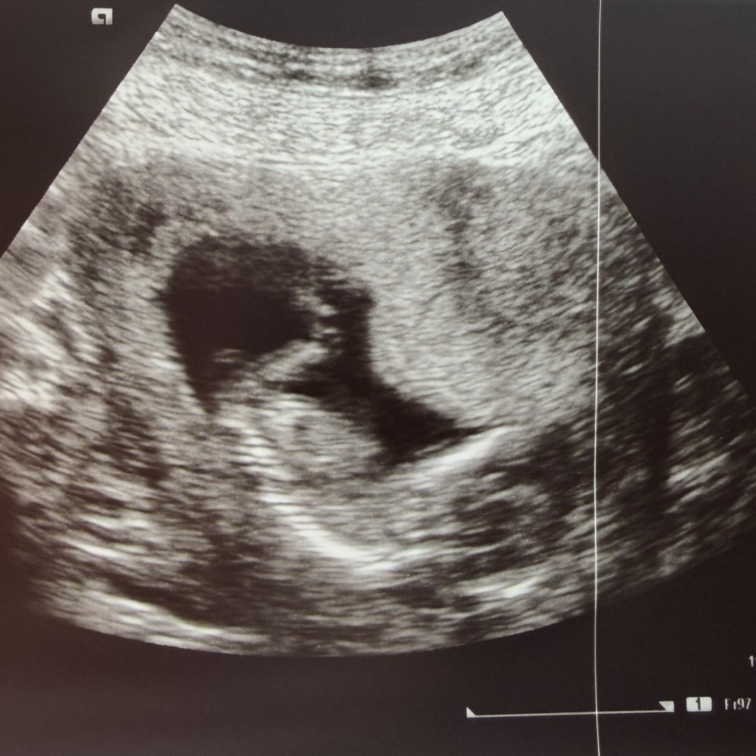 Photo shared by Amelia for their Babylist baby registry.