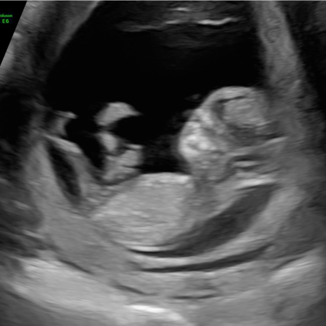 Photo shared by Isabella for their Babylist baby registry.