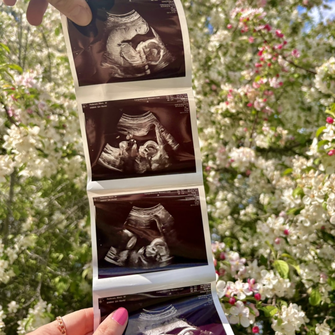 Photo shared by Alexis for their Babylist baby registry.