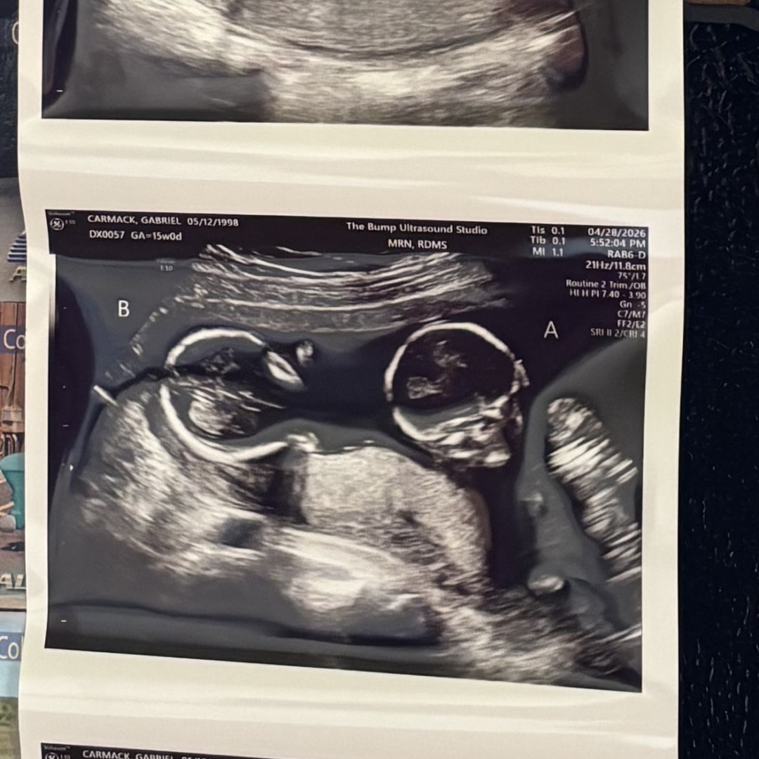 Photo shared by Gabi for their Babylist baby registry.