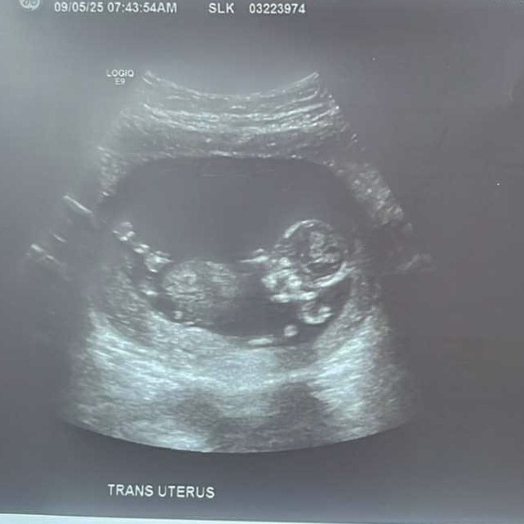 Photo shared by Savannah for their Babylist baby registry.