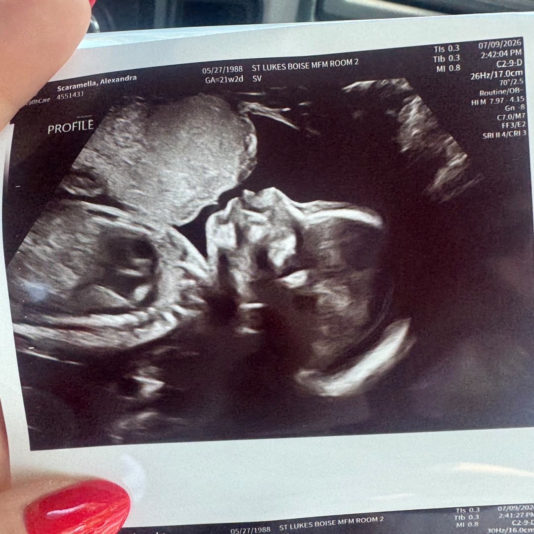 Photo shared by Alex for their Babylist baby registry.